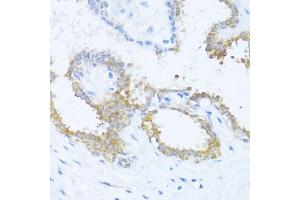 Immunohistochemistry of paraffin-embedded human breast using N antibody (ABIN6132387, ABIN6144378, ABIN6144379 and ABIN6216511) at dilution of 1:100 (40x lens). (NAT2 Antikörper  (AA 171-290))
