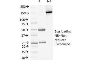SDS-PAGE Analysis Purified DSG1 Mouse Monoclonal Antibody (18D4). (Desmoglein 1 Antikörper)