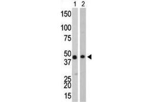 Western Blotting (WB) image for anti-Creatine Kinase, Brain (CKB) antibody (ABIN3002966)