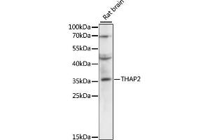 Western blot analysis of extracts of rat brain, using TH antibody (ABIN6133215, ABIN6149107, ABIN6149108 and ABIN6220276) at 1:3000 dilution. (THAP2 Antikörper  (AA 83-228))