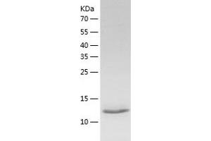Lectin, Galactoside-Binding, Soluble, 1 (LGALS1) (AA 1-135) protein (His-IF2DI Tag)