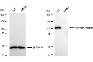 Western blotting analysis using Androgen receptor antibody (ABIN7797599).