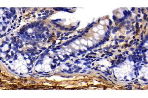 Detection of PINP in Rat Colon Tissue using Polyclonal Antibody to Procollagen I N-Terminal Propeptide (PINP) (PINP Antikörper  (AA 23-151))