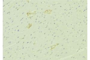 ABIN6276454 at 1/100 staining Mouse liver tissue by IHC-P. (SERPINA3 Antikörper)