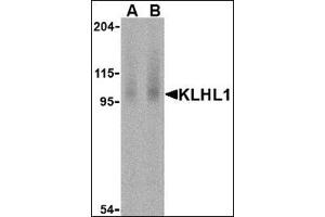 Western blot analysis of KLHL1 in human brain cell lysate with this product at (A) 2 and (B) 4 μg /ml.