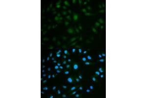 Immunofluorescence analysis of MCF7 cell using IL23R antibody. (IL23R Antikörper)