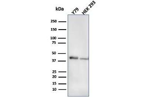 Western Blot Analysis of Y79 and HEK293 cell lysate using CKBB Mouse Monoclonal Antibody (CPTC-CKB-2). (CKB Antikörper)