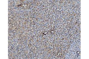 IHC analysis of TAPA1/CD81 using anti-TAPA1/CD81 antibody (ABIN5693258). (CD81 Antikörper  (AA 116-201))