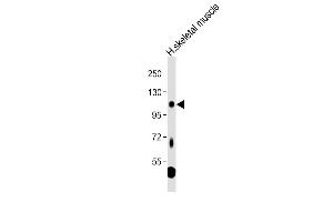 Anti-LGR5 Antibody (loop2) at 1:1000 dilution + Human skeletal muscle tissue lysate Lysates/proteins at 20 μg per lane.
