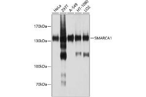 Western blot analysis of extracts of various cell lines, using SM antibody (ABIN6132562, ABIN6148098, ABIN6148099 and ABIN6214424) at 1:1000 dilution. (SMARCA1 Antikörper  (AA 1-200))