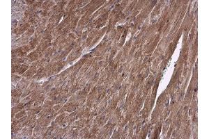 IHC-P Image ALDH7A1 antibody detects ALDH7A1 protein at cytoplasm in mouse heart by immunohistochemical analysis. (ALDH7A1 Antikörper)