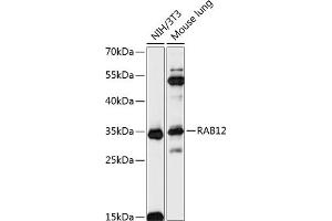 Western blot analysis of extracts of various cell lines, using R antibody (ABIN7269796) at 1:3000 dilution. (RAB12 Antikörper  (AA 1-70))