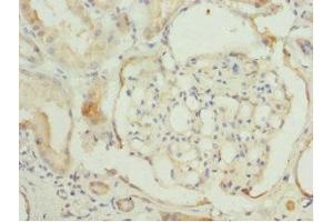 Immunohistochemistry (IHC) image for anti-Chaperonin Containing TCP1, Subunit 2 (Beta) (CCT2) (AA 206-535) antibody (ABIN7171416)