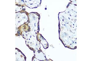 Immunohistochemistry of paraffin-embedded human placenta using RhoA Rabbit pAb (ABIN6134426, ABIN6146932, ABIN6146933 and ABIN6218128) at dilution of 1:100 (40x lens). (RHOA Antikörper  (C-Term))