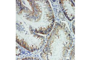 Anti-FER antibody, IHC(P) IHC(P): Rat Intestine Tissue (FER Antikörper  (Middle Region))