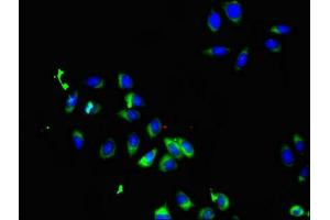 Immunofluorescent analysis of A549 cells using ABIN7169898 at dilution of 1:100 and Alexa Fluor 488-congugated AffiniPure Goat Anti-Rabbit IgG(H+L) (SMO Antikörper  (AA 28-233))