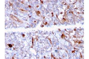 Formalin-fixed, paraffin-embedded human Kidney stained with C1QA Mouse Monoclonal Antibody (C1QA/2956). (C1QA Antikörper  (AA 104-237))