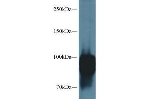 Western blot analysis of Rat Lung lysate, using Rat POSTN Antibody (1 µg/ml) and HRP-conjugated Goat Anti-Rabbit antibody ( (Periostin Antikörper  (AA 659-810))