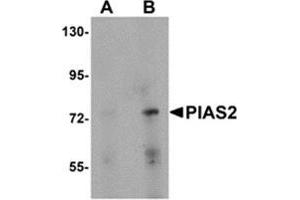 Western blot analysis of PIAS2 in rat brain tissue lysate with PIAS2 antibody at (A) 1 and (B) 2 μg/ml. (PIAS2 Antikörper  (N-Term))