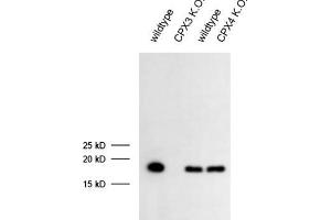 dilution: 1 : 1000 (ECL), sample: mouse retina extract (CPLX3 Antikörper)