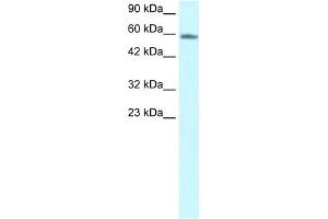 WB Suggested Anti-CHES1 Antibody Titration:  1. (FOXN3 Antikörper  (C-Term))