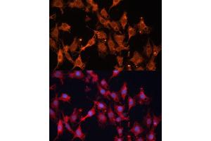 Immunofluorescence analysis of C6 cells using HSD17B1 Polyclonal Antibody (ABIN6129829, ABIN6142002, ABIN6142003 and ABIN6215013) at dilution of 1:100 (40x lens). (HSD17B1 Antikörper  (AA 1-328))
