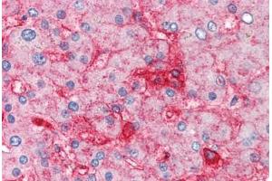 Human Liver (formalin-fixed, paraffin-embedded) stained with B2M antibody ABIN305901 at 5 ug/ml followed by biotinylated anti-mouse IgG secondary antibody ABIN481714, alkaline phosphatase-streptavidin and chromogen. (beta-2 Microglobulin Antikörper)