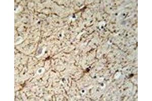 GFAP antibody immunohistochemistry analysis in formalin fixed and paraffin embedded human brain tissue. (GFAP Antikörper)