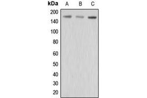 Western blot analysis of MRP3 expression in HepG2 (A), MCF7 (B), MDAMB435 (C) whole cell lysates. (ABCC3 Antikörper  (Center))
