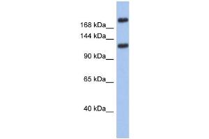 WB Suggested Anti-CACNA1I Antibody Titration: 0. (CACNA1I Antikörper  (Middle Region))