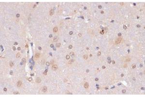 Immunohistochemistry of paraffin-embedded Rat brain using PIDD Polyclonal Antibody at dilution of 1:100 (40x lens). (PIDD Antikörper)