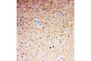 Anti-Serotonin transporter antibody, IHC(P) IHC(P): Rat Brain Tissue (SLC6A4 Antikörper  (N-Term))