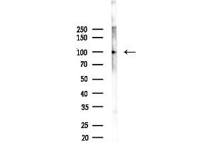anti-SH3-Domain Kinase Binding Protein 1 (SH3KBP1) (N-Term) antibody