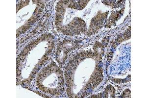 IHC analysis of STAG2 using anti-STAG2 antibody (ABIN7602420).