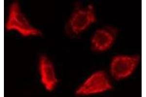ABIN6278325 staining HepG2 cells by IF/ICC. (ERAP1 Antikörper  (Internal Region))