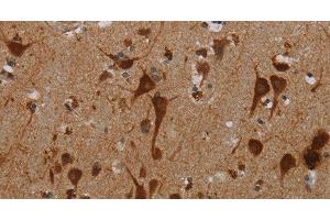 Immunohistochemistry of paraffin-embedded Human brain tissue using KMT2D Polyclonal Antibody at dilution 1:40 (Lysine (K)-Specific Methyltransferase 2B (KMT2B) Antikörper)