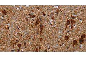 Immunohistochemistry of paraffin-embedded Human brain tissue using KMT2D Polyclonal Antibody at dilution 1:40