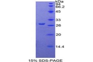 SDS-PAGE (SDS) image for Pyruvate Kinase M2 (PKM2) (AA 324-531) protein (His tag) (ABIN1879303)
