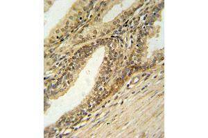 Immunohistochemistry (Paraffin-embedded Sections) (IHC (p)) image for anti-DNA Fragmentation Factor, 40kDa, beta Polypeptide (Caspase-Activated DNase) (DFFB) (AA 1-30), (N-Term) antibody (ABIN653798)