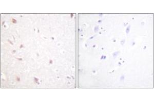 Immunohistochemistry analysis of paraffin-embedded human brain tissue, using NIFK (Ab-234) Antibody.