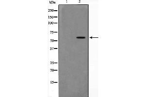 Western blot analysis of extracts of HT-29 cell line,usingPAK4antibody (PAK4 Antikörper  (Internal Region))