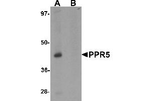 Western blot analysis of PRR5 in SK-N-SH cell lysate with PRR5 antibody at 1 µg/mL in (A) the absence and (B) the presence of blocking peptide