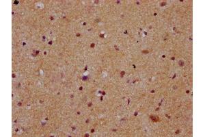 IHC image of ABIN7168374 diluted at 1:300 and staining in paraffin-embedded human brain tissue performed on a Leica BondTM system. (MEX3B Antikörper  (AA 253-375))
