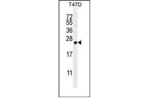 Western blot analysis of GAGE12B Antibody (N-term) in T47D cell line lysates (35ug/lane). (G Antigen 12B Antikörper  (N-Term))