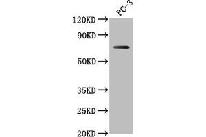 Western Blot Positive WB detected in: PC-3 whole cell lysate All lanes: DVL1P1 antibody at 1:1000 Secondary Goat polyclonal to rabbit IgG at 1/50000 dilution Predicted band size: 74, 73 kDa Observed band size: 74 kDa
