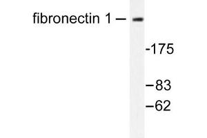 Image no. 1 for anti-Fibronectin antibody (ABIN272101) (Fibronectin Antikörper)