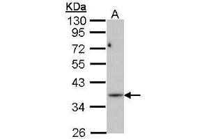 PRPS1L1 Antikörper