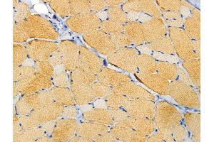 ABIN6258681 and ABIN6274241 at 1/100 staining Rat skin tissue by IHC-P. (ACTN2/3 Antikörper  (N-Term))