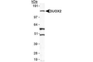 Western blot analysis of DUOX2 in A-549 in cell lysate using DUOX2 polyclonal antibody . (DUOX2 Antikörper  (AA 400-500))