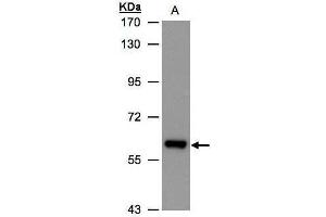 WB Image Sample(30 ug whole cell lysate) A:Hep G2, 7. (ALDH6A1 Antikörper)